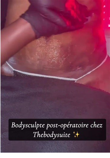 Le drainage post-opératoire est une étape essentielle pour accompagner le corps après une intervention ✨ Il aide à réduire les œdèmes, améliorer la circulation lymphatique, favoriser la récupération et affiner progressivement la silhouette. Chaque geste est précis, doux et adapté à chaque corps 🤍 #DrainagePostOperatoire #PostOpCare #LymphaticDrainage #BodySculpt #RecuperationPostOp