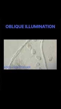 Infusoria Under the Microscope #microscopy #brightfield #darkfield #science
