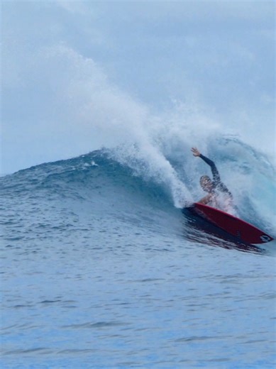 Surfing Adventures and Overcoming Injuries