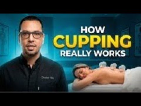 How Cupping Therapy Really Works (Science Explained)