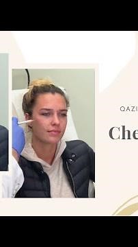 Cheek Fillers Using Radiesse | Live with Dr. Nadir Qazi