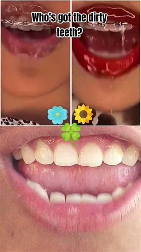 #duet #edit #kpop #aesthetic #kikakim #abcd #ytshorts #reaction #ytshortsvideo #xoteam #relatable