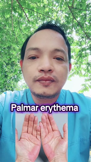 Palmar Erythema: Understanding Causes and Symptoms