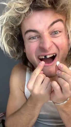 TOPPER GUILD LOSES TOOTH PRANK - #Shorts