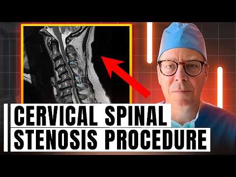 Cervical Spinal Stenosis Procedure | What to Expect