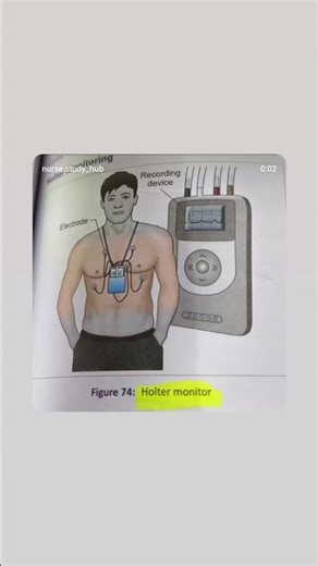 Holter monitor 💫#norcet #nursingofficeronline #likeandsubscribe