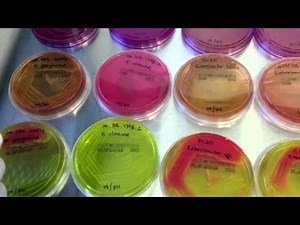 Enterobacteriaceae on different media