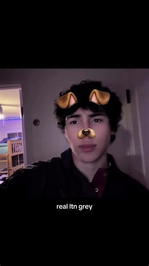 uhhhhh #fyp #foryoupage #zyemogsu #mog #bp | mog antibody disease