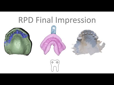 RPD Final Impression in 5 mins