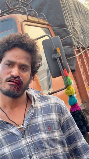 Movie shooting blood scene 🎬👍￼