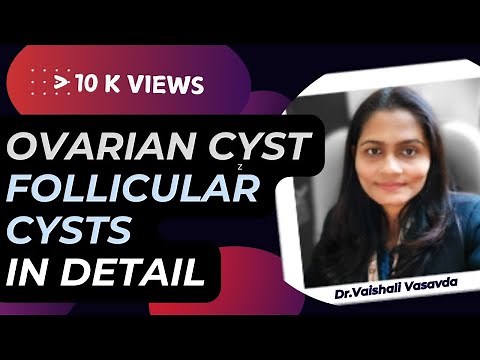 Follicular Cyst || Ovarian Cyst || Dr.Vaishali Vasavda