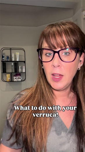 What Not to Do for Verruca Treatment