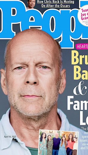 47K views · 1.5K reactions | We’re back with a new episode on the Brain Health Revolution Podcast: Bruce Willis and His Battle With Aphasia. We explored the term aphasia, which has become a popular term in the media after Bruce Willis announced his diagnosis. We discussed the definition of aphasia, it’s presentation, the different conditions that present with aphasia, management and treatment. Link to the YouTube video: https://youtu.be/ZFF6A4Vcznk | Sherzai MD, The Brain Docs | Facebook