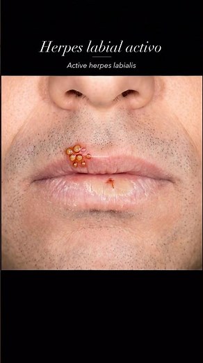 12 Lip Conditions You Should NEVER Ignore! 👄🚨 #shorts #health