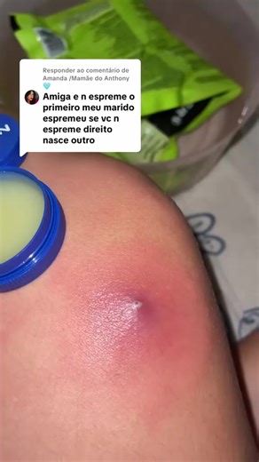 2.8K views | Let's Clean Up 2025  (6) | Pimple Popper | Facebook