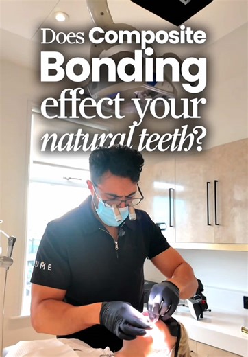 Understanding Composite Bonding in Dentistry