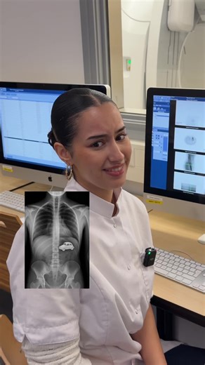 Bizar maar waar: soms vind je écht hele gekke objecten terug op een scan... 🪥🚗 #mbrt #inholland #studiekeuze