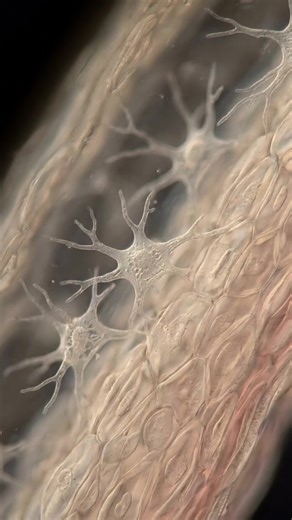 Langerhans cells the silent detectors guarding your skin from danger. Langerhans cells live quietly between the thin layers of your skin, acting like hidden surveillance sensors. They stretch out long branching arms, sweeping the surface for tiny clues from the outside world. Dust, microbes, pollen, chemicals — everything passes through their reach. They don’t panic. They analyze. They decide what is harmless and what could be a threat, keeping the skin calm instead of constantly inflamed. But t