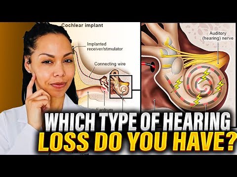 3 Types of Hearing Loss (And What They Mean)