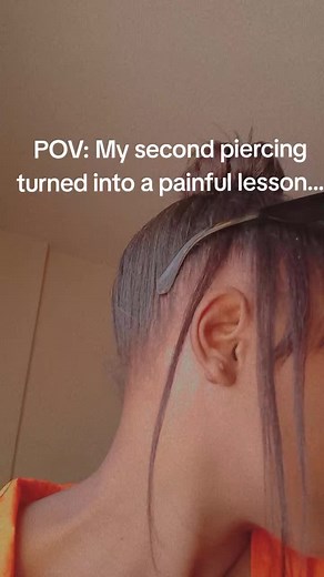 Understanding Keloids: Pain from Piercings Explained