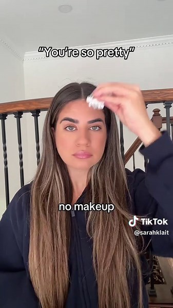This is a vulnerable post so please be kind ❤️ #naturalbeauty #nomakeup