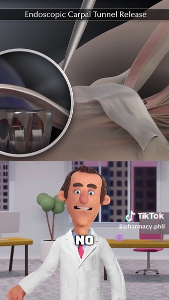 Understanding Carpal Tunnel Syndrome and Treatment Options