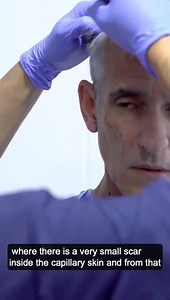 How to rejuvenate tired eyes