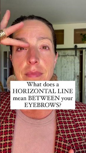 WHAT is the HORIZONTAL LINE between the EYEBROWS? fc8c53187e094542af4c7b64253964f9