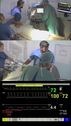 Intraoperative Hypoxia – Theatre Simulation Scenario