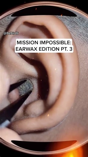 Smart Visual Ear Pick for Easy Ear Cleaning