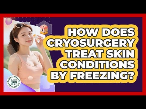 How Does Cryosurgery Treat Skin Conditions By Freezing? - Healthy Skin Brief