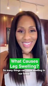 What Causes Leg Swelling? | Dr. Jen Caudle