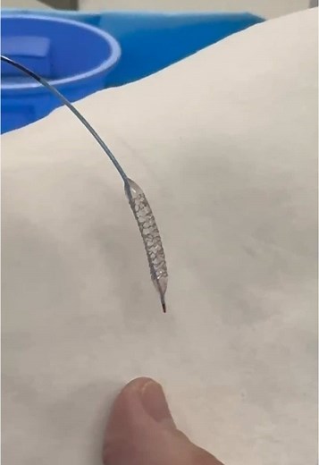 Entendiendo el cateterismo cardíaco y stents