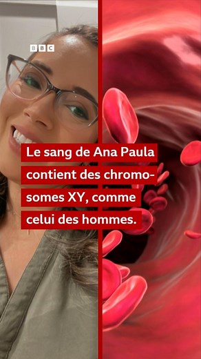 Contrairement au reste de son corps, les cellules sanguines d'Ana Paula Martins possèdent les chromosomes XY de son frère, ce qu'elle et ses médecins ont découvert récemment par hasard. #santé #sang | BBC News Afrique