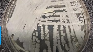 CDC says ‘superbug’ fungus has spread in Washington, D.C., and Dallas