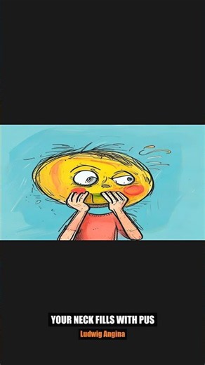 Ludwig's Angina — when a toothache closes your throat