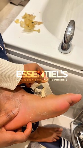 1.3K views · 574 reactions | Zéro douleur, zéro risque. Seulement des pieds doux. Avec FOOT PEEL MASK™, des pieds lisses, doux et régénérés en quelques jours. Validé par des experts, approuvé par des milliers d’utilisateurs ivoiriens. -50% aujourd’hui seulement + livraison offerte !  Faites votre commande maintenant. | Essentiel's | Facebook