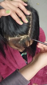 biggest dandruff scratching huge flake removal on head#4545 Part 1 | Showerer