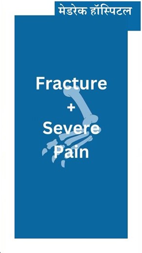 टूटी हड्डी? Plates और Screws से होती है Fracture Fixation Surgery! | Hindi