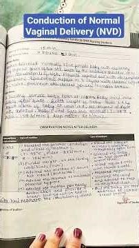 Conduction of Normal Vaginal Delivery//#NVD// #Midwifery Casebook #NVD //#ytshorts //#nmnursingpoint