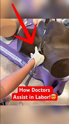 What Really Happens During a Forceps Delivery