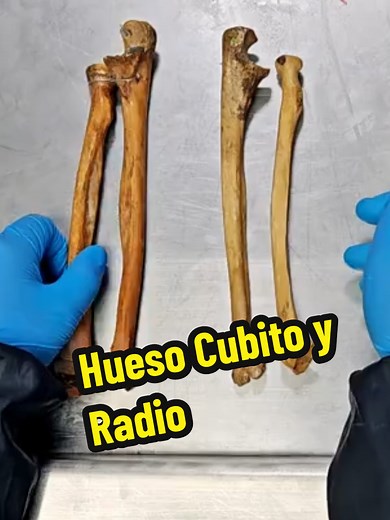 Anatomía del Cúbito y Radio: Huesos del Antebrazo