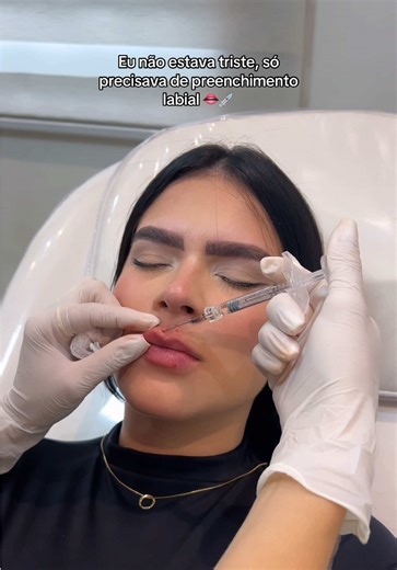 Lip Fillers: Transform Your Look with Confidence