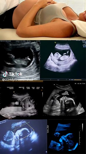 Fetal Development in the Womb: Second Trimester Ultrasound