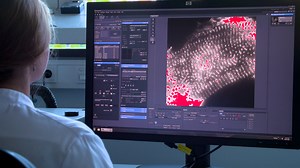 Analyzing the α-Actinin Network in Human iPSC-Derived Cardiomyocytes Using Single Molecule Localization Microscopy