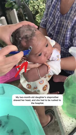 My daughter's father shaved her head until she got a head infection. #hospital #father #madrasta