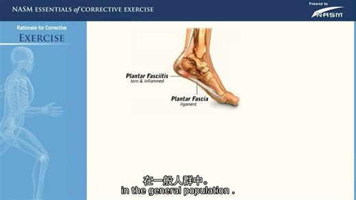 01纠正练习的理由-肌肉骨骼疼痛