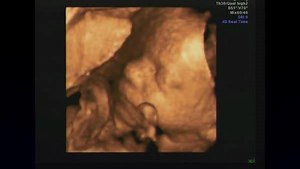 147K views · 3.7K reactions | Planned Parenthood aborts over 300,000...