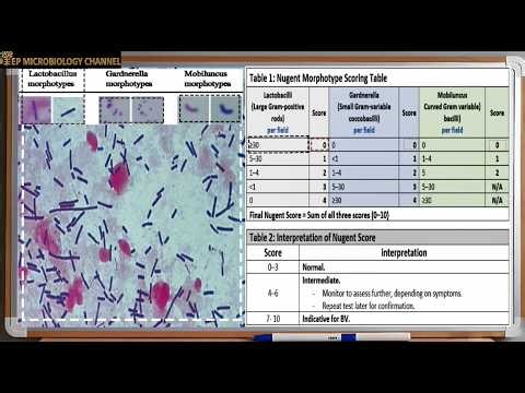 high vaginal swab ( HVS)