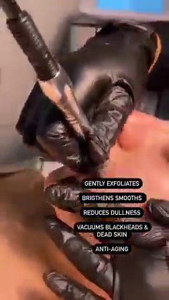 Diamond Microdermabrasion  #DiamondMicrodermabrasion is a...